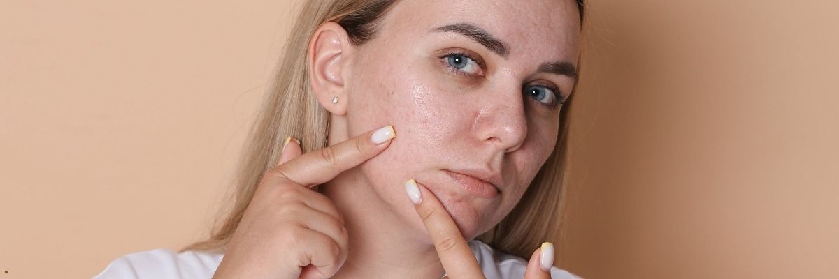 Hormonların Cilt Sağlığı Üzerindeki Etkileri Nelerdir