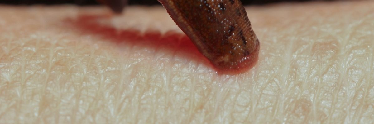 Slugging Nasıl Yapılır
